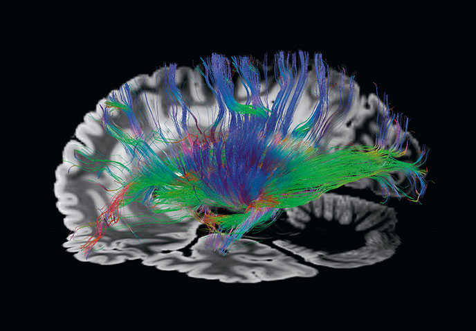 Picture of a healthy brain