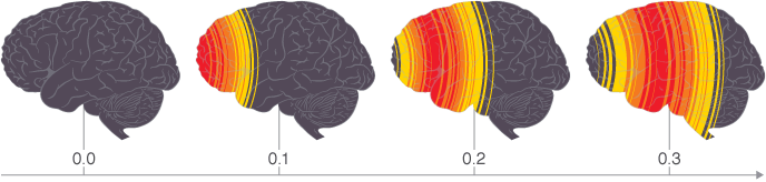 Illustration of blast wave effect on the brain