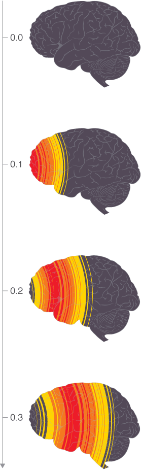 Illustration of blast wave effect on the brain